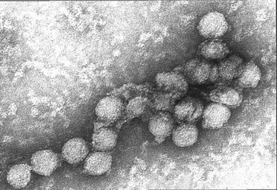 西尼罗病毒:西尼罗病毒的我国的流行状况